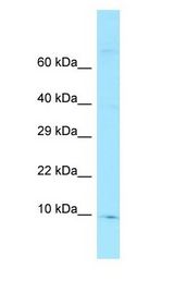 FKBP1A / FKBP12 antibody Western Blot of 721_B.