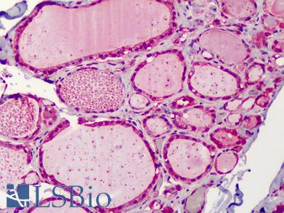 Anti-FKBP1A / FKBP12 antibody IHC of human thyroid. Immunohistochemistry of formalin-fixed, paraffin-embedded tissue after heat-induced antigen retrieval. Antibody LS-B2265 concentration 5 ug/ml.