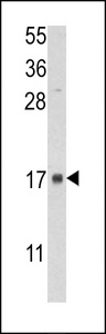 Western blot of lysate from human placenta tissue lysate, using FKBP2 Antibody. Antibody was diluted at 1:1000 at each lane. A goat anti-rabbit IgG H&L (HRP) at 1:5000 dilution was used as the secondary antibody. Lysate at 35ug per lane.
