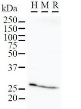 Western blot of immunized recombinant protein using FKBP3 antibody. Detection of FBP3 by Western Blot. Samples: Whole cell lysate from human HeLa (H, 50 ug), mouse NIH3T3 (M, 50 ug) and rat F2408 (R, 50 ug) cells.