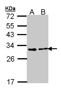 Sample (30 ug of whole cell lysate). A: A431. B: H1299. 12% SDS PAGE. FKBP3 antibody diluted at 1:1000.
