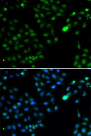 Immunofluorescence blot of HeLa cell using FKBP3 antibody. Blue: DAPI for nuclear staining.