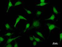 Immunostaining analysis in HeLa cells. HeLa cells were fixed with 4% paraformaldehyde and permeabilized with 0.1% Triton X-100 in PBS. The cells were immunostained with anti-FKBP3 mAb.
