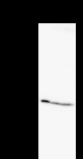 Detection of FKBP3 by Western blot. Samples: Whole cell lysate from human HeLa (H, 50 ug) , mouse NIH3T3 (M, 50 ug) and rat F2408 (R, 50 ug) cells. Predicted molecular weight: 25 kDa