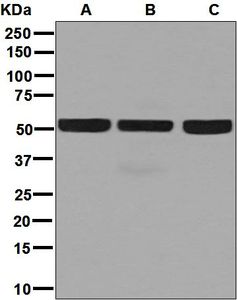 Western blot analysis on (A) HeLa, (B) Jurkat, and (C) 293T cell lysates using anti-FKBP8 / FKBP38 antibody.
