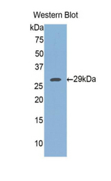 Western blot of recombinant FKBP38 / FKBP8.