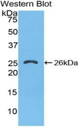 Western blot of recombinant FKBP38 / FKBP8.