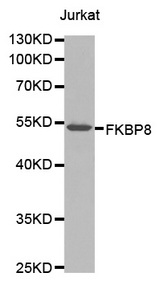Western blot analysis of extracts of Jurkat cells lines, using FKBP8 antibody.
