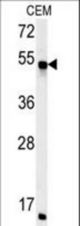 FKBP8 Antibody western blot of CEM cell line lysates (35 ug/lane). The FKBP8 antibody detected the FKBP8 protein (arrow).