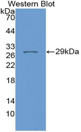 Western blot of recombinant FKBP38 / FKBP8.