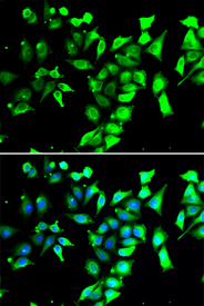 Immunofluorescence blot of A549 cell using FKBP8 antibody. Blue: DAPI for nuclear staining.