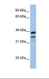 Fetal brain lysate. Antibody concentration: 1.0 ug/ml. Gel concentration: 12%.