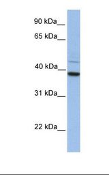 Hela cell lysate. Antibody concentration: 1.0 ug/ml. Gel concentration: 12%.