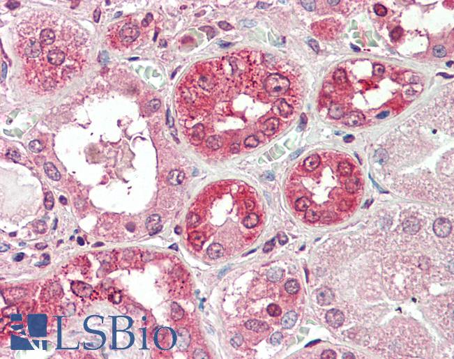 Anti-COG8 antibody IHC staining of human kidney. Immunohistochemistry of formalin-fixed, paraffin-embedded tissue after heat-induced antigen retrieval. Antibody LS-B10298 concentration 5 ug/ml.