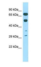 COIL / Coilin antibody Western Blot [Target Name] antibody. Sample Tissue:Rat Testis lysates. Antibody Dilution: 1.0 ug/ml.