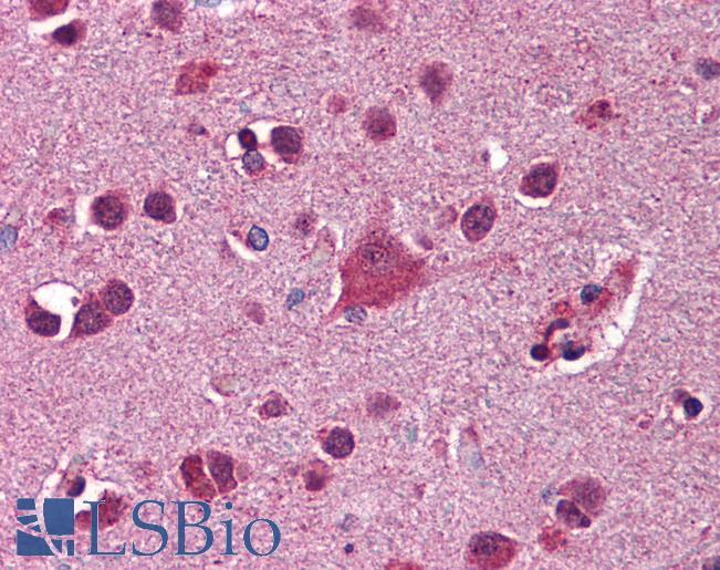 Anti-FKBP5 antibody IHC of human brain, cortex. Immunohistochemistry of formalin-fixed, paraffin-embedded tissue after heat-induced antigen retrieval. Antibody LS-B5851 concentration 2.5 ug/ml.