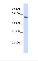 HepG2 cell lysate. Antibody concentration: 1.0 ug/ml. Gel concentration: 12%.
