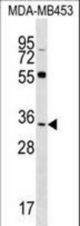 FKBP6 Antibody western blot of MDA-MB453 cell line lysates (35 ug/lane). The FKBP6 antibody detected the FKBP6 protein (arrow).
