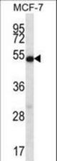 COIL Antibody western blot of MCF-7 cell line lysates (35 ug/lane). The COIL antibody detected the COIL protein (arrow).