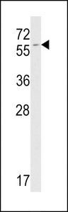 Western blot of FKBP9 antibody in mouse NIH-3T3 tissue lysates (35 ug/lane). FKBP9 (arrow) was detected using the purified antibody.
