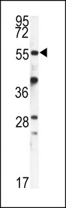 Western blot of FKBP9 antibody in mouse kidney tissue lysates (35 ug/lane). FKBP9 (arrow) was detected using the purified antibody.