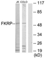 Western blot of extracts from Jurkat/COLO205 cells, using FKRP Antibody. The lane on the right is treated with the synthesized peptide.