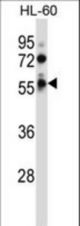 FKRP Antibody western blot of HL-60 cell line lysates (35 ug/lane). The FKRP antibody detected the FKRP protein (arrow).