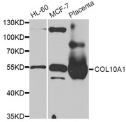 Western blot blot of extracts of various cell lines, using COL10A1 antibody.