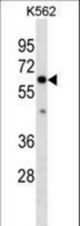 COL10A1 Antibody western blot of K562 cell line lysates (35 ug/lane). The COL10A1 antibody detected the COL10A1 protein (arrow).