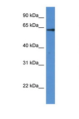 FLCN / Folliculin antibody LS-C145402 Western blot of Fetal Heart lysate. Antibody concentration 1 ug/ml.