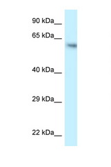FLCN / Folliculin antibody LS-C145628 Western blot of HCT15 Cell lysate. Antibody concentration 1 ug/ml.