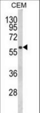 Western blot of FLCN Antibody in CEM cell line lysates (35 ug/lane). FLCN (arrow) was detected using the purified antibody.