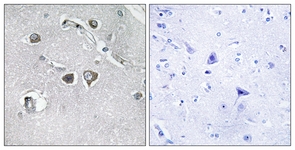 IHC of paraffin-embedded human brain tissue, using Collagen XI alpha2 Antibody. The picture on the right is treated with the synthesized peptide.