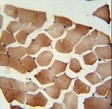 FLCN Antibody immunohistochemistry of formalin-fixed and paraffin-embedded human skeletal muscle followed by peroxidase-conjugated secondary antibody and DAB staining.