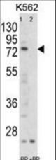 Western blot of FLCN Antibody antibody pre-incubated without(lane 1) and with(lane 2) blocking peptide in K562 cell line lysate. FLCN (arrow) was detected using the purified antibody.