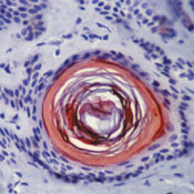 Formalin-fixed, paraffin-embedded human skin stained with peroxidase-conjugate and AEC chromogen. Note cytoplasmic staining of keratinized epithelial cells of hair follicle.