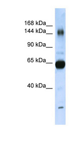 COL11A2 antibody LS-C107795 Western blot of Placenta lysate.
