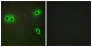Immunofluorescence of A549 cells, using Collagen XIII alpha1 Antibody. The sample on the right was incubated with synthetic peptide.