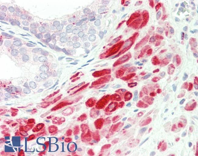 Human, Prostate: Formalin-Fixed Paraffin-Embedded (FFPE)