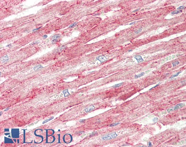 Human, Heart: Formalin-Fixed Paraffin-Embedded (FFPE)