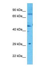 Western blot of CODA1 Antibody with human 786-0 Whole Cell lysate.