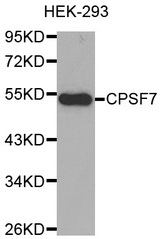 Western blot analysis of extracts of HEK-293 cell line, using CPSF7 antibody.