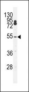 CPSF7 Antibody western blot of K562 cell line lysates (35 ug/lane). The CPSF7 antibody detected the CPSF7 protein (arrow).