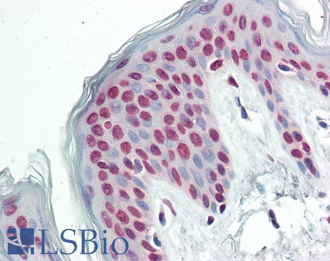 Anti-FLJ12529 / CPSF7 antibody IHC staining of human skin. Immunohistochemistry of formalin-fixed, paraffin-embedded tissue after heat-induced antigen retrieval. Antibody LS-B11465 concentration 10 ug/ml.