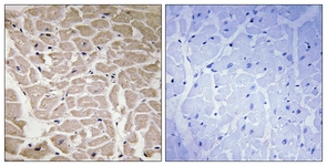 IHC of paraffin-embedded human heart tissue, using Collagen XVI alpha1 Antibody. The sample on the right was incubated with synthetic peptide.