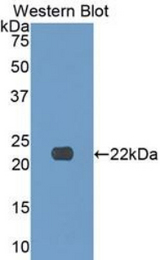 Western blot of recombinant COL17A1 / Collagen XVII.