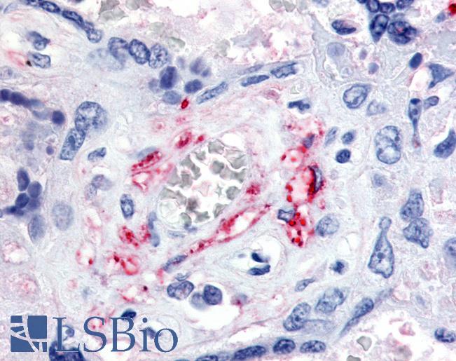 Anti-VEGFR1 antibody LS-A9405 IHC of human placenta, fetal capillary endothelial cells. Immunohistochemistry of formalin-fixed, paraffin-embedded tissue after heat-induced antigen retrieval.