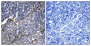 IHC of paraffin-embedded human thymus gland tissue, using Collagen XIX alpha1 Antibody. The picture on the right is treated with the synthesized peptide.