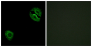 Immunofluorescence of A549 cells, using Collagen XIX alpha1 Antibody. The picture on the right is treated with the synthesized peptide.
