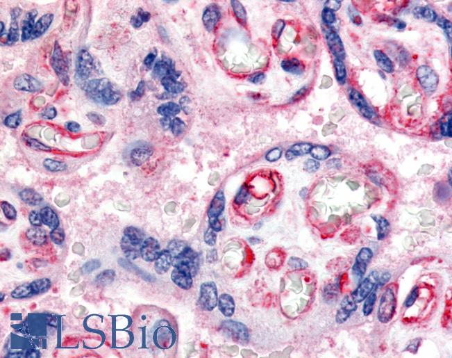 Anti-VEGFR1 antibody LS-A9440 IHC of human placenta, fetal capillary endothelial cells. Immunohistochemistry of formalin-fixed, paraffin-embedded tissue after heat-induced antigen retrieval.